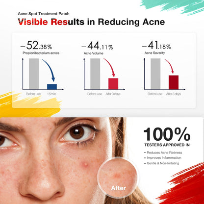LED Acne Spot Treatment Patch — Advanced Premium Skincare Solution