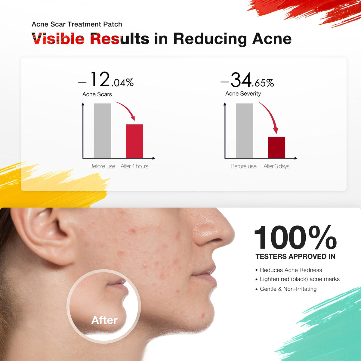 LED Acne Spot Treatment Patch — Advanced Premium Skincare Solution
